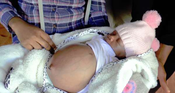 BABY BORN WITH STOMACH CYST!!! "unbelievable BUT it happened"